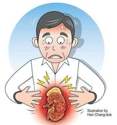 58歲男子腎癌晚期，回家天天喝酒打牌，誰勸都沒用：不想治了